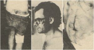 Kostas kappos mpogiati kentriki